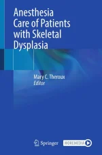 Anesthesia Care of Patients With Skeletal Dysplasia