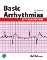 Basic Arrhythmias