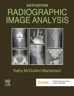 Radiographic Image Analysis