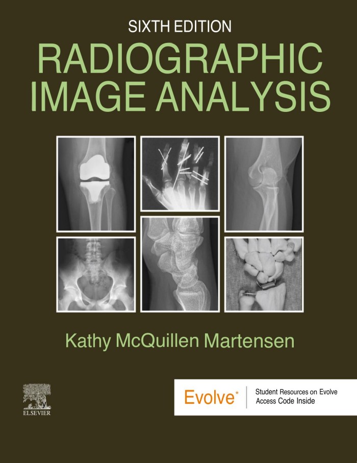 Radiographic Image Analysis Radiographic Image Analysis